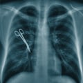 What is the root cause of medical malpractice liability?